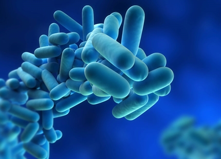 Legionnaires' disease - what you need to know